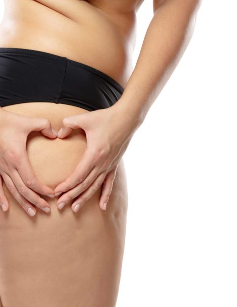 Overweight woman with fat cellulite legs and buttocks, obesity female body in black underwear isolated on white background. Orange peel skin, liposuction, beauty, healthcare and beauty treatment.